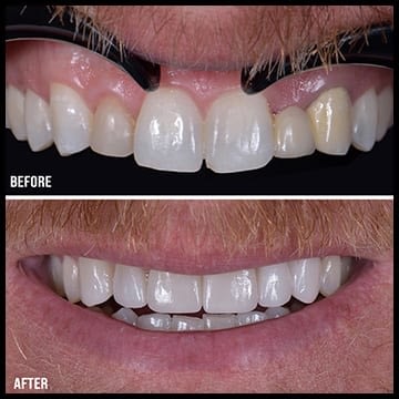 Displays the before and after of Sbenati Dentistry's world class cosmetic dentistry service.
